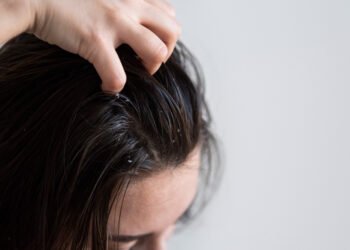 Como cuidar do cabelo oleoso sem piorar a raiz