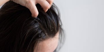 Como cuidar do cabelo oleoso sem piorar a raiz